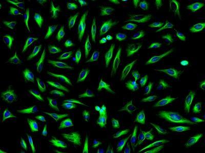 HeLa cells were incubated with mouse anti-tubulin and biotin goat anti-mouse IgG followed by AAT's FITC-streptavidin conjugate (Green). Cell nuclei were stained with Hoechst 33342 (Blue, Cat#17530).