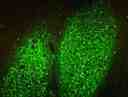 Image of Fluoro-Jade&reg; C labeling in cells using a fluorescence microscope with FITC filter.