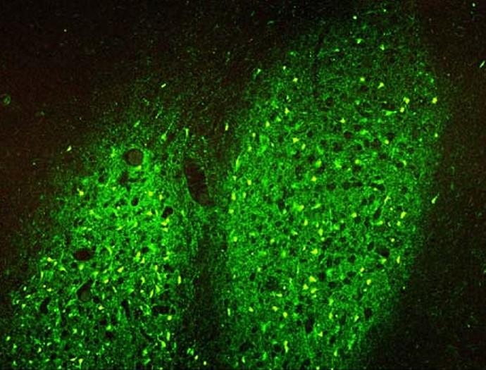 Image of Fluoro-Jade® C labeling in cells using a fluorescence microscope with FITC filter.