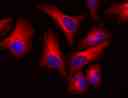HeLa cells were stained with mouse anti-tubulin and then followed with iFluor<sup>TM</sup>&nbsp;610 goat anti-mouse IgG (H+L). Cells were&nbsp;mounted in FluoroQuest&trade; Mounting Medium with DAPI (Cat# 20004).