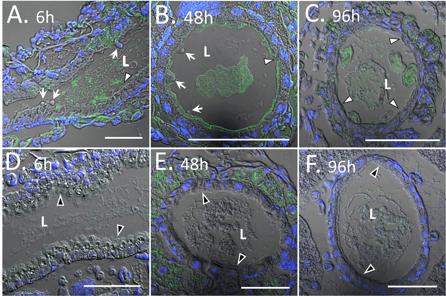 Western corn rootworm midgut morphology after feeding with Vpb4Da2. Vpb4Da2 staining by Alexa-fluor-488 conjugated secondary antibody is in green. Nuclei staining by DAPI is in blue. (A) Longitudinal section of the midgut after 6 h exposure to Vpb4Da2. (B) Cross section after 48 h exposure to Vpb4Da2. (C) Cross section after 96 h exposure to Vpb4Da2. (A) and (B) White arrows indicate blebbing of the epithelial cells. (A), (B) and (C) White arrowheads designate a complete or near complete loss of the apical microvilli layer. (D), (E), and (F) Are untreated controls where black arrowheads indicate the intact apical microvilli layer. Scale bars are all 50 μm.
Source: <b>Structural and functional insights into the first Bacillus thuringiensis vegetative insecticidal protein of the Vpb4 fold, active against western corn rootworm</b> by
Kouadio JL, Zheng M, Aikins M, Duda D, Duff S, et al. <em>PLOS ONE</em> Dec. 2021.