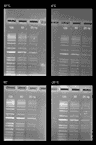 Stability test on Gelite™ Safe DNA Gel Stain, which was dissolved in DMSO and stored at four different temperatures (-20°C, 4°C, room temperature, and 37°C) for a period of three months. After storage, DNA ladders (100, 50, and 25 ng) were loaded in 1% agarose gel for 60 minutes at 75 V. Gels were incubated with Gelite™ Safe DNA Gel Stain for 1 hour. The image was captured in SYBR green filter set (Exposure time= 1.5 sec).