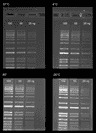 Stability test on Gelite™ Safe DNA Gel Stain, which was dissolved in water and stored at four different temperatures (-20°C, 4°C, room temperature, and 37°C) for a period of three months. After storage, DNA ladders (100, 50, and 25 ng) were loaded in 1% agarose gel for 60 minutes at 75 V. Gels were incubated with Gelite™ Safe DNA Gel Stain for 1 hour. The image was captured in SYBR green filter set (Exposure time= 1.5 sec).