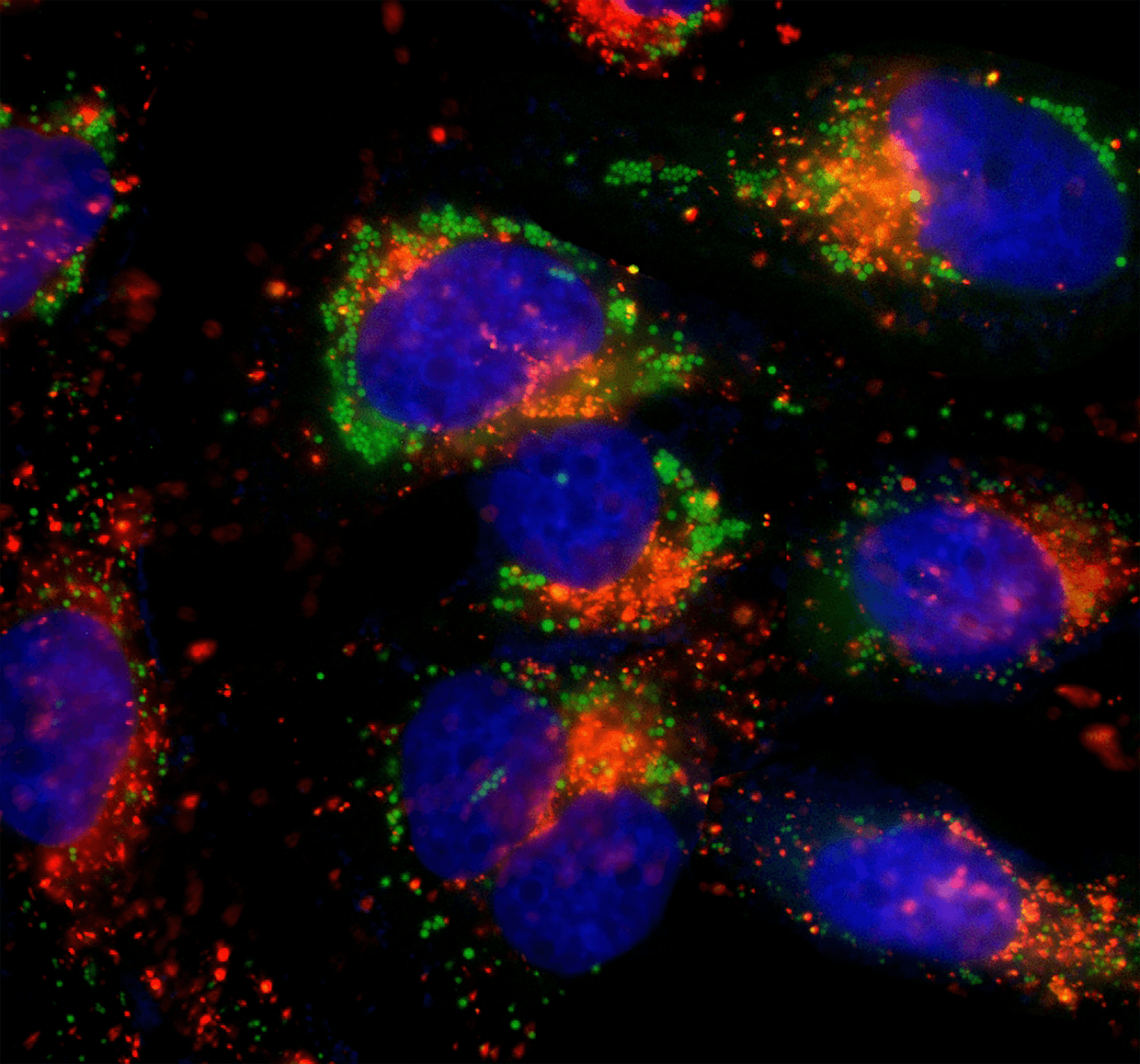 HeLa cells were incubated in 1X HBSS buffer with 5% serum to induce starvation. Following starvation, cells were treated with Autophagy Green™ (Cat No. 23002) working solution for 20 minutes in a 37°C, 5% CO<sub>2</sub> incubator and then washed 3 times. Nuclei were labeled with Hoechst 33342 (Cat No. 17530). Lysosomes were labeled with LysoBrite™ Orange (Cat No. 22657).