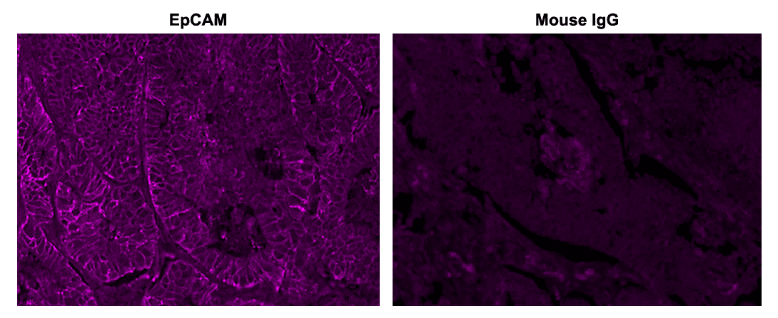 Formalin-fixed, paraffin-embedded (FFPE) human lung adenocarcinoma tissue was incubated with an anti-EpCAM primary antibody, and an HRP conjugated anti-mouse secondary antibody. TSA signal was developed by incubation of tissue section with 5 µg/mL of iFluor® 430 tyramide (Cat No. 45096) for 10 minutes. Images were acquired on a confocal microscope equipped with a Violet filter set.