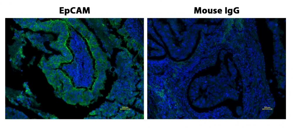 Fluorescence IHC of formaldehyde-fixed, paraffin-embedded human lung adenocarcinoma positive tissue using PSA<strong> ™</strong> amplified methods. Human lung adenocarcinoma positive tissue sections were stained with Mouse anti-EpCAM or Control Mouse IgG antibody and then incubated with polyHRP-labeled Goat anti-Mouse IgG secondary antibody followed by iFluor® 440 Styramide™ (Cat#44900).
