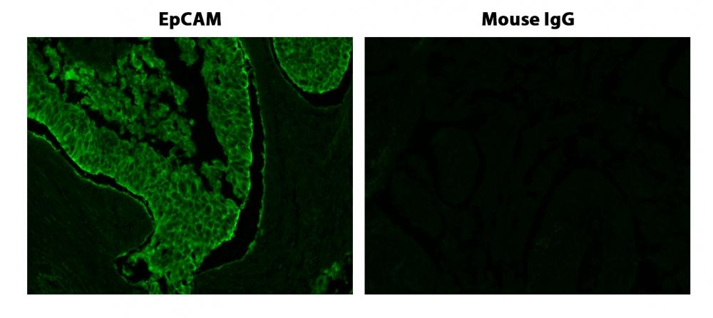 Fluorescence IHC of formaldehyde-fixed paraffin-embedded tissue. Human lung adenocarcinoma sections were incubated with&nbsp;Mouse mAb EpCAM and then incubated with HRP-labeled Goat anti-mouse IgG secondary antibody followed by iFluor® 450 Styramide&trade; (Cat#45010) stain. Fluorescence images were taken using the FITC filter set.