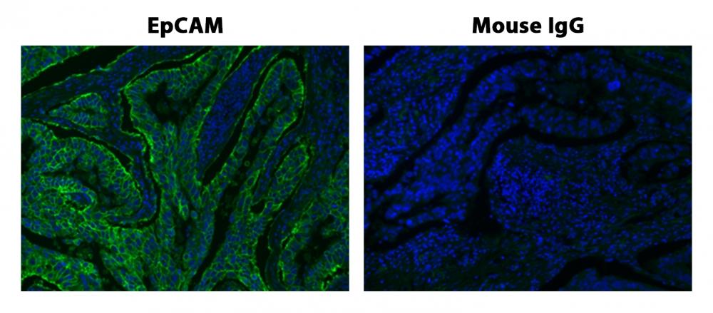 Fluorescence IHC of formaldehyde-fixed, paraffin-embedded human lung adenocarcinoma positive tissue using iFluor<strong>&trade;</strong>&nbsp;450 Tyramide. Human lung adenocarcinoma positive tissue sections were stained with&nbsp;Mouse anti-EpCAM or Control Mouse IgG antibody and then incubated with polyHRP-labeled Goat anti-Mouse IgG secondary antibody followed by iFluor® 450 Tyramide&trade; (Cat#45097).