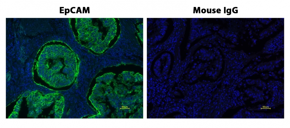 Fluorescence IHC of formaldehyde-fixed, paraffin-embedded human lung adenocarcinoma positive tissue using PSA<strong> ™</strong> amplified methods. Human lung adenocarcinoma positive tissue sections were stained with Mouse anti-EpCAM or Control Mouse IgG antibody and then incubated with polyHRP-labeled Goat anti-Mouse IgG secondary antibody followed by iFluor® 460 Styramide™ (Cat#44902).