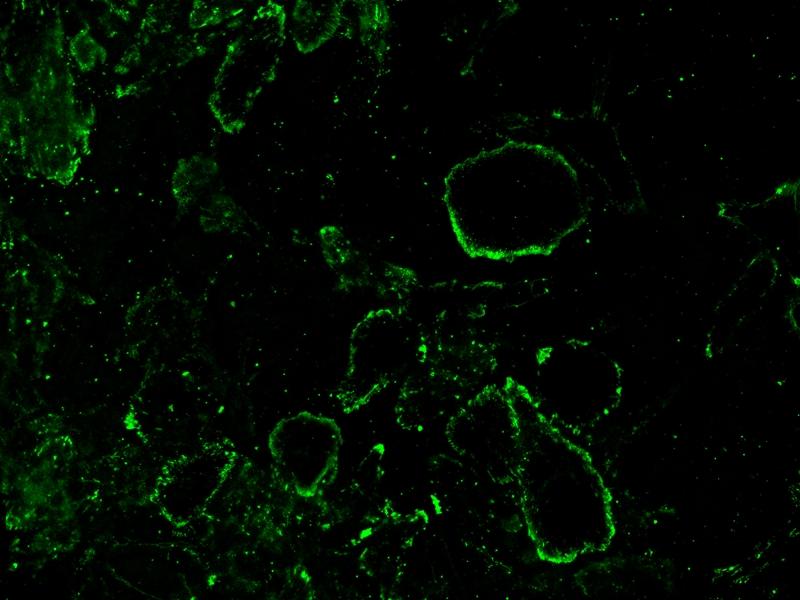 Live HeLa cells were stained with&nbsp;iFluor® 488-Concanavalin A Conjugate Conjugate at 5&nbsp;&micro;g/mL for 30 minutes. Image was acquired using fluorescence microscopy using FITC filter set.