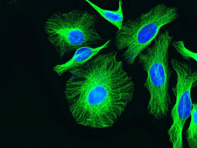 HeLa cells were stained with rabbit anti-tubulin followed by iFluor 488 goat anti-rabbit IgG (H+L) *Cross Adsorbed*, and nuclei were stained Nuclear Blue DCS1 (Cat#17548).