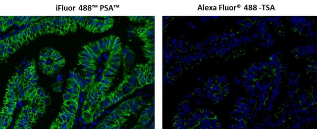 Fluorescence IHC of formaldehyde-fixed, paraffin-embedded using PSA<strong> &trade; </strong>&nbsp;and TSA amplified methods. Human lung adenocarcinoma positive tissue sections were stained with mouse anti-EpCam antibody and then followed by PSA&trade; method using iFluor 488&trade; PSA&trade; Imaging Kit with Goat Anti-Mouse IgG (Cat#45260) or TSA method using&nbsp; Alexa Fluor&reg; 488 tyramide&nbsp; respectively.&nbsp; Images showed that PSA&trade; super signal amplification can increase the sensitivity of fluorescence IHC over Alexa Fluor&reg; 488 TSA method. Cell nucleus were stained with Nuclear Blue&trade; DCS1 (Cat#17548).