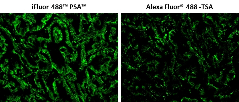 Fluorescence IHC of formaldehyde-fixed, paraffin-embedded human lung adenocarcinoma positive tissue using PSA<strong> ™ </strong> and TSA amplified methods. Human lung adenocarcinoma positive tissue sections were stained with rabbit anti-EpCam antibody and then incubated with polyHRP-labeled Goat anti-Rabbit IgG secondary antibody followed by iFluor® 488 Styramide™ (Cat#45020) or Alexa Fluor® 488 tyramide stain respectively. Images showed that iFluor 488™ PSA™ super signal amplification can increase the sensitivity of fluorescence IHC over Alexa Fluor® 488 TSA method.