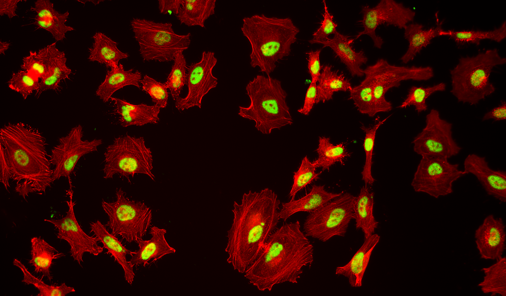 Fluorescence microscopy analysis of cells stained with rabbit anti-Histone H3 antibody followed by iFluor® 514 goat anti-rabbit IgG (H+L) secondary antibody. F-actin was counterstained with Phalloidin-iFluor® 647.