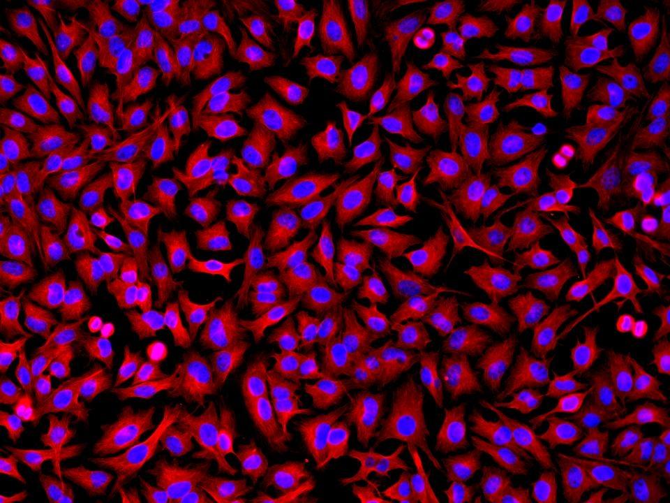 HeLa cells were incubated with rabbit anti-tubulin followed by iFluor™ 514 goat anti-rabbit IgG conjugate. Cell nuclei were stained with Hoechst 33342 (Blue, Cat# 17530).