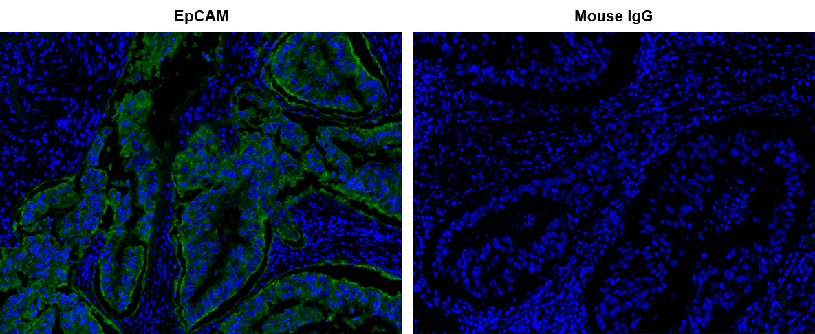 Fluorescence IHC of formaldehyde-fixed, paraffin-embedded human lung adenocarcinoma positive tissue using PSA™ amplified methods. Human lung adenocarcinoma positive tissue sections were stained with Mouse anti-EpCAM or Control Mouse IgG antibody and then incubated with polyHRP-labeled Goat anti-Mouse IgG secondary antibody followed by iFluor® 514 Styramide™ (Cat. 45022).