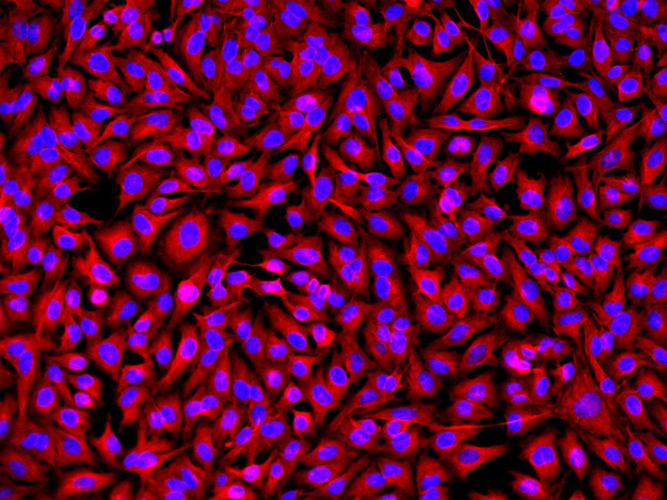 HeLa cells were incubated with rabbit anti-tubulin followed by iFluor® 532 goat anti-rabbit IgG conjugate. Cell nuclei were stained with Hoechst 33342 (Blue, Cat# 17530).
