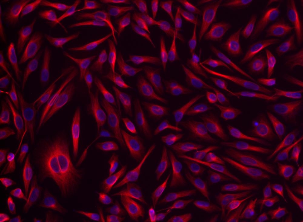 <p>HeLa cells were incubated with rabbit anti-tubulin followed by iFluor<sup>TM</sup> 532 goat anti-rabbit IgG conjugate (Red). Cell nuclei were stained with Hoechst 33342 (Blue, Cat#17530).</p>