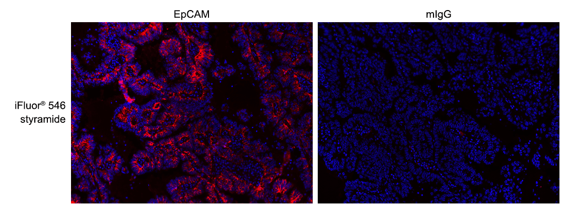 Formalin-fixed, paraffin-embedded (FFPE) human lung tissue was labeled with anti-EpCAM mouse mAb followed by HRP-labeled goat anti-mouse IgG (Cat No. 16728). The fluorescence signal was developed using iFluor® 546 styramide (Cat No. 45025) and detected with a TRITC/Cy3 filter set. Nuclei (blue) were counterstained with DAPI (Cat No. 17507).