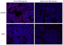 Formalin-fixed, paraffin-embedded (FFPE) human lung tissue was labeled with anti-EpCAM mouse mAb followed by HRP-labeled goat anti-mouse IgG (Cat No. 16728). The fluorescence signal was developed using iFluor® 546 tyramide (Cat No. 45103) or Alexa Fluor® 546 tyramide and detected with a TRITC/Cy3 filter set. Nuclei (blue) were counterstained with DAPI (Cat No. 17507).