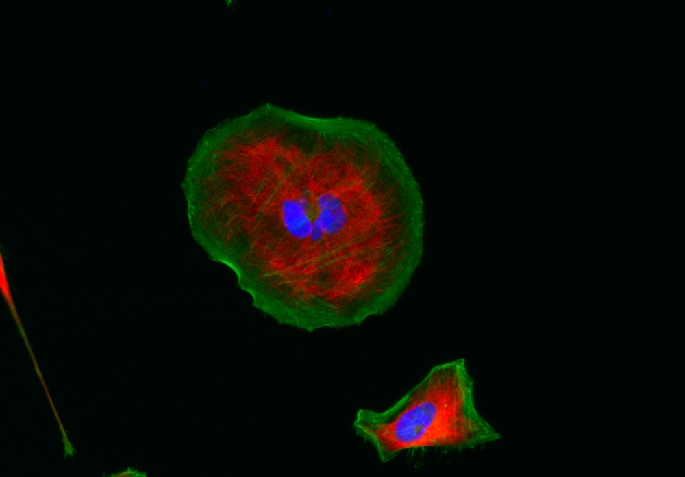 <p>HeLa cells were stained with rabbit anti-tubulin followed with iFluor<sup>TM</sup> 555 goat anti-rabbit IgG (H+L) (red); actin filaments were stained with Phalloidin-iFluor<sup>TM</sup> 488 conjugate (green); and nuclei were stained with DAPI (blue).</p>