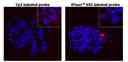 Fluorescence In Situ Hybridization of Cy3 and iFluor® 555-dUTP labelled Telomere probes in metaphase HeLa cells.