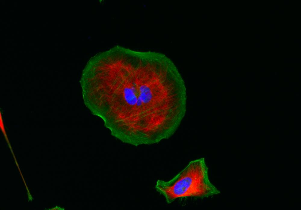 HeLa cells were stained with mouse anti-tubulin followed with&nbsp;iFluor<sup>TM</sup>&nbsp;555 goat anti-mouse IgG (H+L) (red); actin filaments were stained with Phalloidin-iFluor<sup>TM</sup> 488 conjugate (green); and nuclei were stained with DAPI&nbsp;(blue).