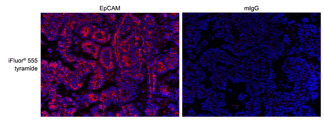 Formalin-fixed, paraffin-embedded (FFPE) human lung tissue was labeled with anti-EpCAM mouse mAb followed by HRP-labeled goat anti-mouse IgG (Cat No. 16728). The fluorescence signal was developed using iFluor® 555 tyramide (Cat No. 45105) and detected with a TRITC/Cy3 filter set. Nuclei (blue) were counterstained with DAPI (Cat No. 17507).