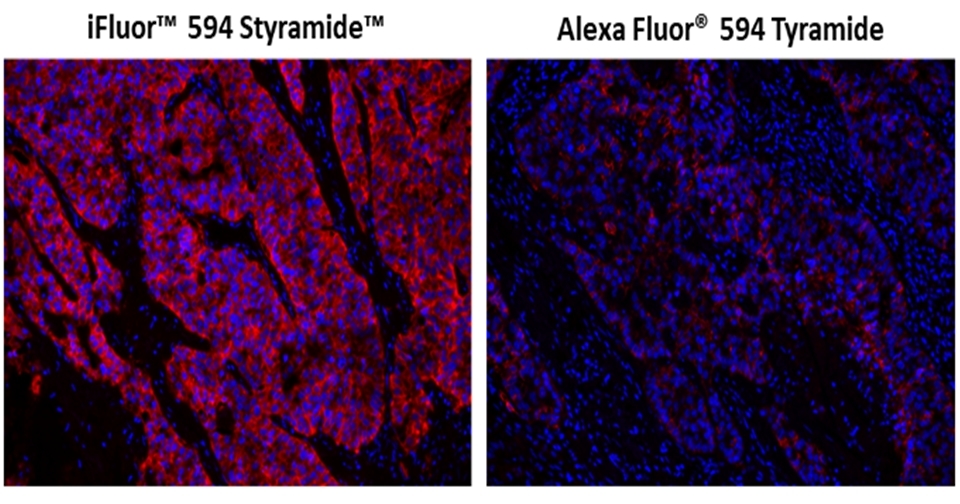 Fluorescence IHC in formaldehyde-fixed paraffin-embedded tissue. Human lung adenocarcinoma sections were incubated with Rabbit mAb EpCAM then stained a HRP-labeled Goat anti-Rabbit IgG secondary antibody followed by iFluor® 594 Styramide™ (Left) or Alexa Fluor® 594 tyramide (Right), respectively. Fluorescence images were taken using the TRITC filter set and under the same exposure time. Cell nucleus was stained with Nuclear Blue™ DCS1 (Cat#17548).