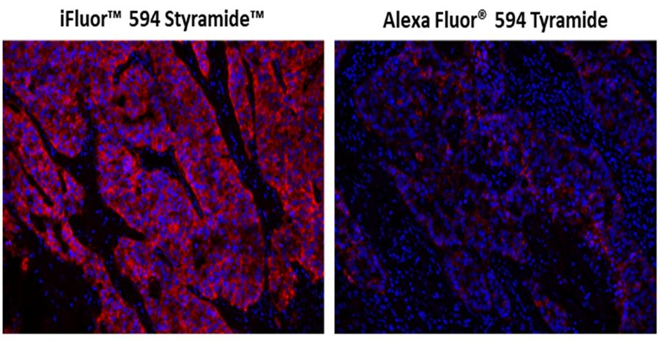 Fluorescence IHC in formaldehyde-fixed paraffin-embedded tissue. Human lung adenocarcinoma sections were incubated with Rabbit mAb EpCAM then stained a HRP-labeled Goat anti-Rabbit IgG secondary antibody followed by iFluor™ 594 Styramide™ (Left) or Alexa Fluor® 594 tyramide (Right), respectively. Fluorescence images were taken using the TRITC filter set and under the same exposure time. Cell nucleus was stained with Nuclear Blue™ DCS1 (Cat#17548).