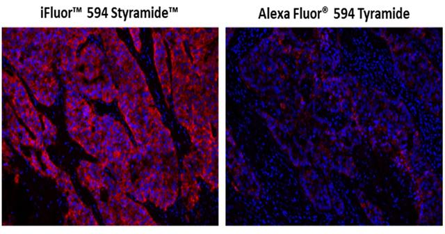 Fluorescence IHC in formaldehyde-fixed paraffin-embedded tissue. Human lung adenocarcinoma sections were incubated with Rabbit mAb EpCAM then stained a HRP-labeled Goat anti-Rabbit IgG secondary antibody followed by iFluor® 594 Styramide&trade; (Left) or Alexa Fluor&reg; 594 tyramide (Right), respectively. Fluorescence images were taken using the TRITC filter set and under the same exposure time. Cell nucleus was stained with Nuclear Blue&trade; DCS1 (Cat#17548).