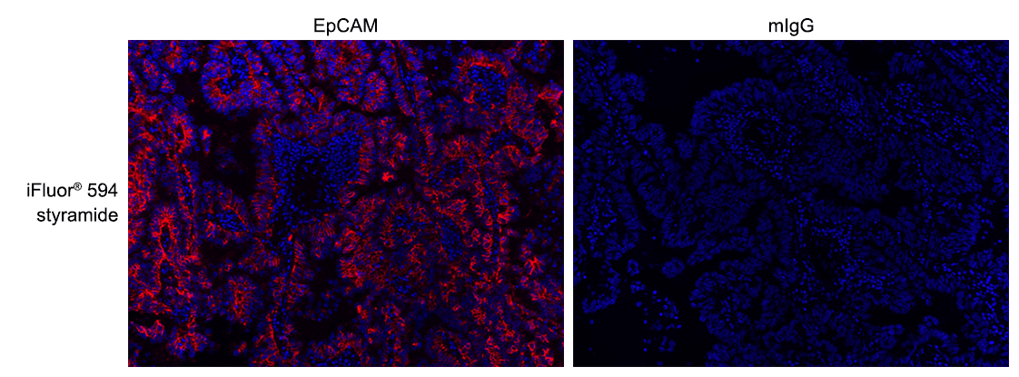 Formalin-fixed, paraffin-embedded (FFPE) human lung tissue was labeled with anti-EpCAM mouse mAb followed by HRP-labeled goat anti-mouse IgG (Cat No. 16728). The fluorescence signal was developed using iFluor® 594 styramide (Cat No. 45035) and detected with a TRITC/Cy3 filter set. Nuclei (blue) were counterstained with DAPI (Cat No. 17507).