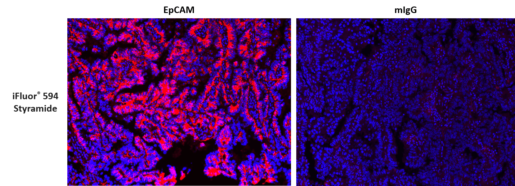 Formalin-fixed, paraffin-embedded (FFPE) human lung tissue was labeled with anti-EpCAM mouse mAb followed by HRP-labeled goat anti-mouse IgG (Cat No. 16728). The fluorescence signal was developed using iFluor® 594 styramide (Cat No. 45035) and detected with a TRITC/Cy3 filter set. Nuclei (blue) were counterstained with DAPI (Cat No. 17507).