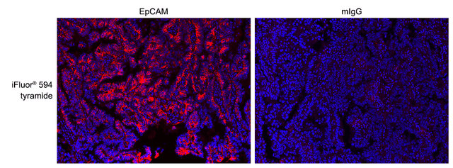 Formalin-fixed, paraffin-embedded (FFPE) human lung tissue was labeled with anti-EpCAM mouse mAb followed by HRP-labeled goat anti-mouse IgG (Cat No. 16728). The fluorescence signal was developed using iFluor® 594 tyramide (Cat No. 45107) and detected with a TRITC/Cy3 filter set. Nuclei (blue) were counterstained with DAPI (Cat No. 17507).