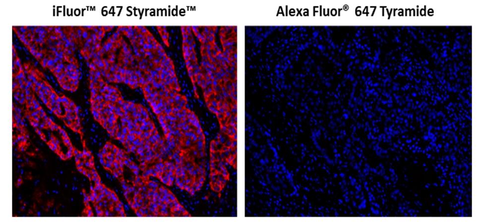 Fluorescence IHC in formaldehyde-fixed paraffin-embedded tissue. Human lung adenocarcinoma sections were incubated with Rabbit mAb EpCAM then stained a HRP-labeled Goat anti-Rabbit IgG secondary antibody followed by iFluor™ 647 Styramide™ (Left) or Alexa Fluor® 647 tyramide (Right), respectively. Fluorescence images were taken using the Cy5 filter set and under the same exposure time. Cell nucleus was stained with Nuclear Blue™ DCS1 (Cat#17548).