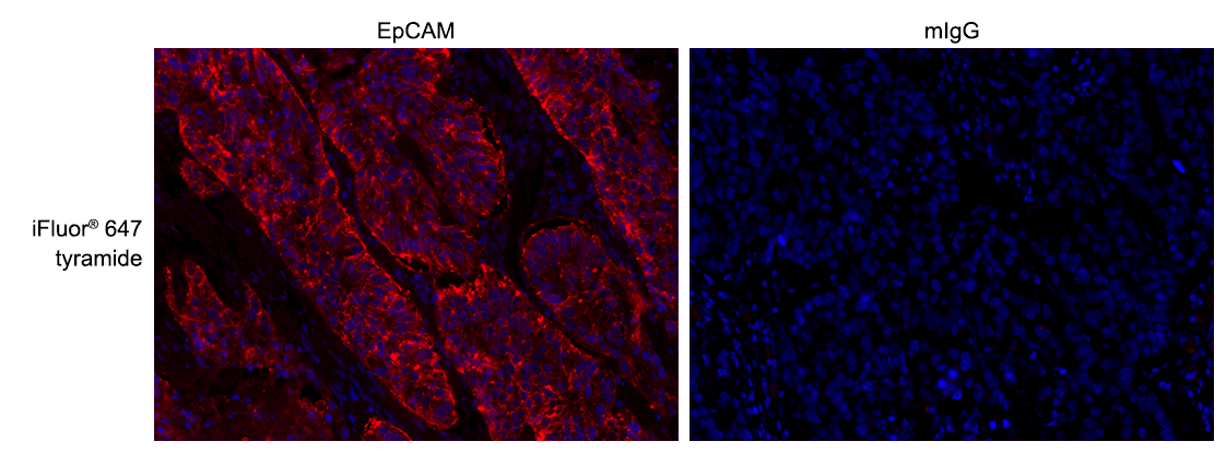 Formalin-fixed, paraffin-embedded (FFPE) human lung tissue was labeled with anti-EpCAM mouse mAb followed by HRP-labeled goat anti-mouse IgG (Cat No. 16728). The fluorescence signal was developed using iFluor® 647 tyramide (Cat No. 45110) and detected with a Cy5 filter set. Nuclei (blue) were counterstained with DAPI (Cat No. 17507).