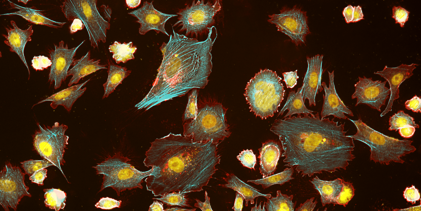 Fluorescence image of CPA47 cells stained with Phalloidin-iFluor® 405 Conjugate, Wheat Germ Agglutinin (WGA)-iFluor® 750 Conjugate, and Nuclear Red™ LCS1. Cells were fixed with 4% formaldehyde, permeabilized with 0.2% Triton™ X-100, then stained with Phalloidin-iFluor® 405 Conjugate (Cat. #23111) for F-actin detection, Wheat Germ Agglutinin (WGA)-iFluor® 750 Conjugate (Cat. #25562) for cell-surface labeling, and Nuclear Red™ LCS1 (Cat. #17542) for nuclear counterstaining. Images were acquired using violet/DAPI, Cy7, and Cy5 filter sets, respectively.
