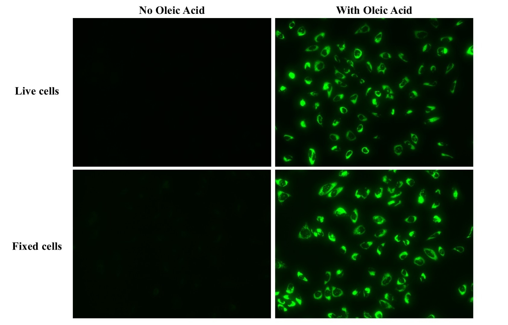 Fluorescence images of intracellular lipid droplets in control (left) and oleic acid-treated HeLa cells (right) stained with LipidLite™ Green Neutral Lipid Stain. HeLa cells were incubated with 100 µM oleic acid for 24 hours to induce intracellular lipid droplet formation. After washing with PBS, cells were labeled with LipidLite™ Green Neutral Lipid Stain and images were acquired using a FITC filter set. Top: live cells; Bottom: 4% PFA-fixed cells.
