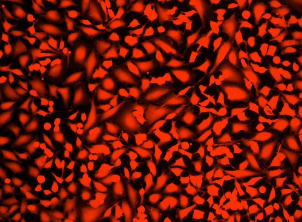 Image of Hela cells fixed with formaldehyde and stained with Live or Dead&trade; Fixable Dead Cell Staining kit&nbsp;*Orange Fluorescence*&nbsp;in a Costa black wall/clear bottom 96-well plate.