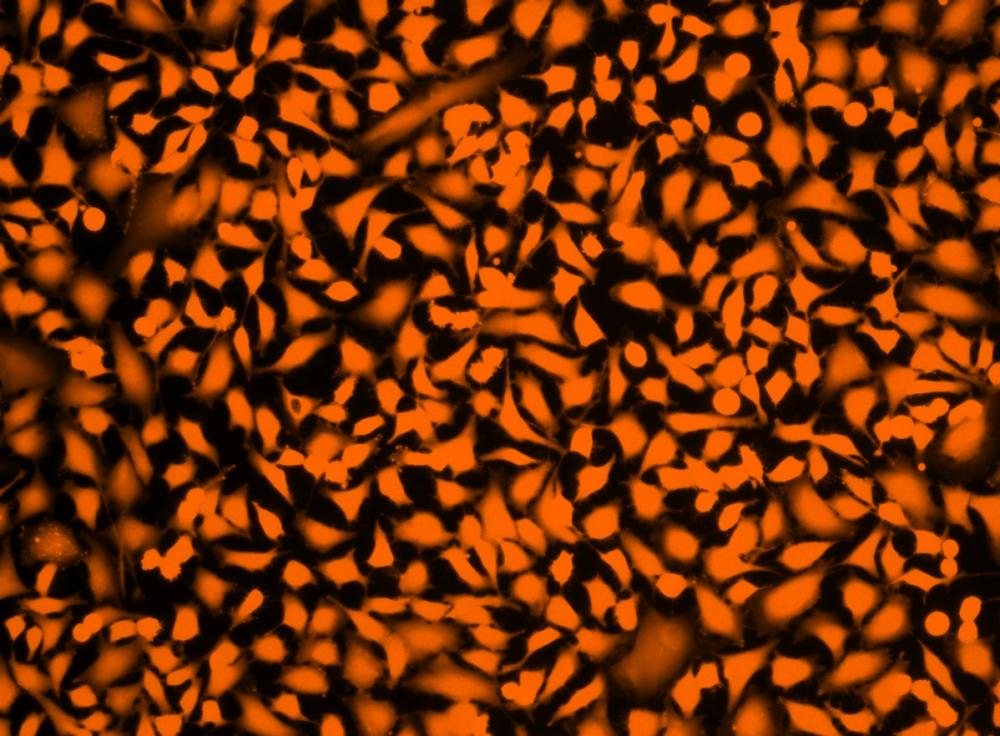 Image of Hela cells fixed with formaldehyde and stained with Live or Dead™ Fixable Dead Cell Staining kit *Orange Fluorescence with 405 nm Excitation* in a Costa black wall/clear bottom 96-well plate.