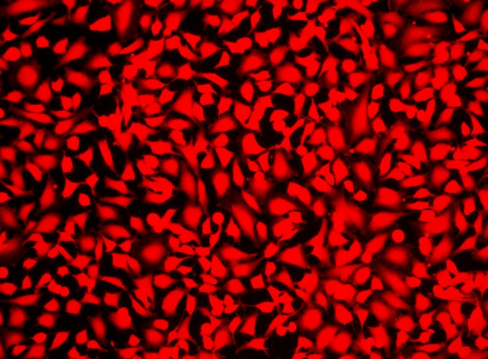 Image of Hela cells fixed with formaldehyde and stained with Live or Dead&trade; Fixable Dead Cell Staining kit&nbsp;*Red Fluorescence*&nbsp;in a Costa black wall/clear bottom 96-well plate.