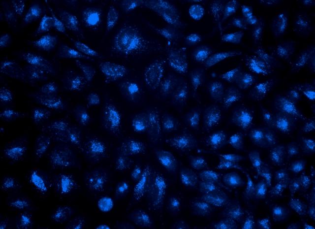 Image of HeLa cells stained with Cell Navigator® Lysosomal Staining Kit in a Costar black wall/clear bottom 96-well plate.