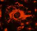 Image of Hela cells stained with LysoBrite™ Deep Red.