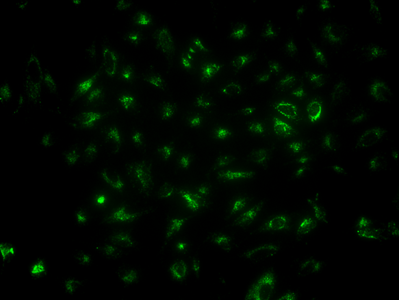 Images of HeLa cells stained with LysoBrite™ Green DND-26 (Cat No. 22648) in a costar black wall/clear bottom 96-well plate. The cells were imaged using a fluorescence microscope with a FITC filter set.