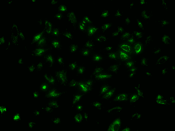 Images of HeLa cells stained with LysoBrite™ Green DND-26 (Cat No. 22648) in a costar black wall/clear bottom 96-well plate. The cells were imaged using a fluorescence microscope with a FITC filter set.