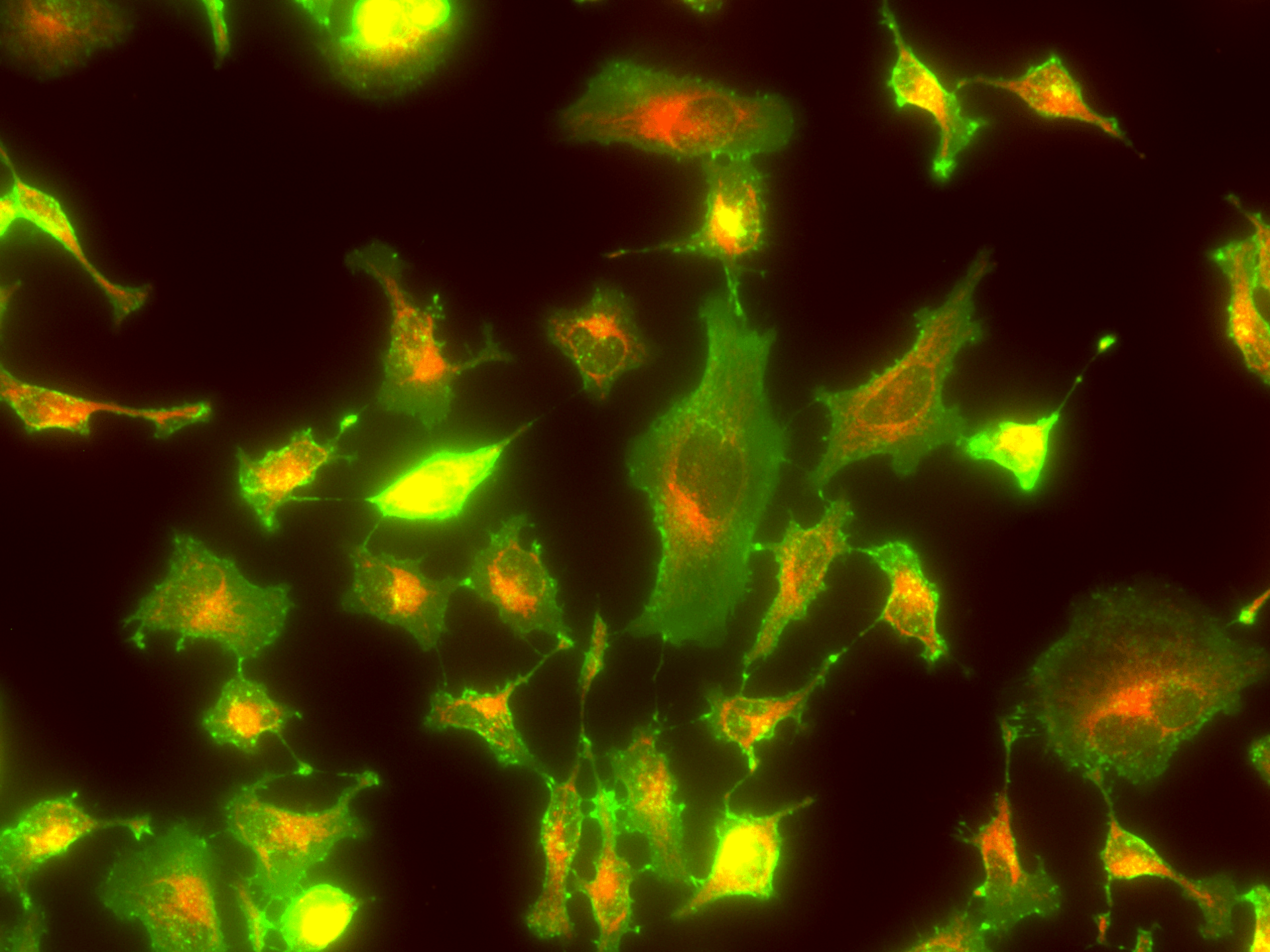 Fluorescence image of live HeLa cells co-stained with iFluor® 488-Wheat Germ Agglutinin (WGA) Conjugate and LysoBrite™ NIR. Live HeLa cells were stained with iFluor® 488-WGA Conjugate (5 µg/mL) and LysoBrite™ NIR (1X) for 30 minutes. Images were acquired using FITC and Cy5 filter sets, respectively, and overlaid to show cell-surface glycoconjugates in green and lysosomes in far-red.