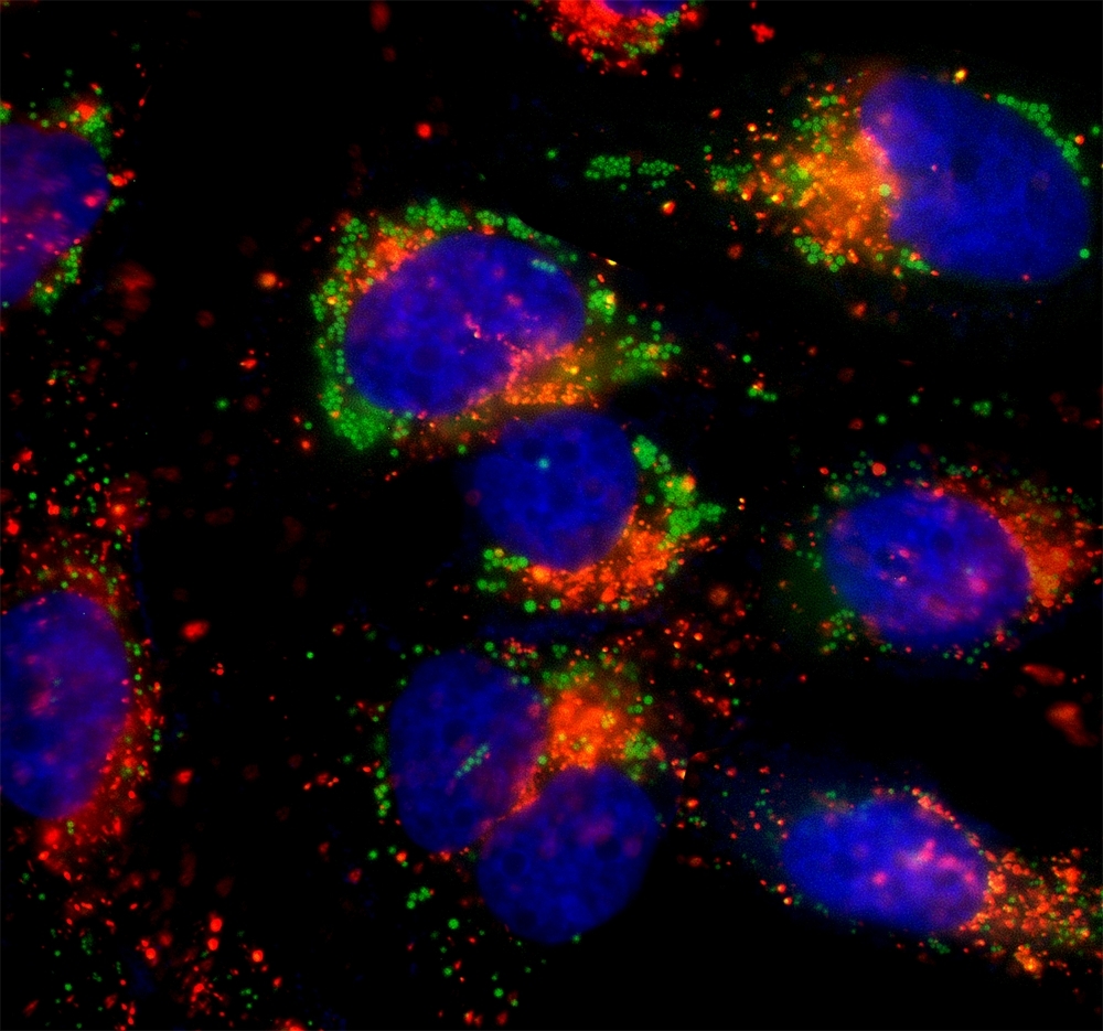 HeLa cells were incubated in 1X HBSS buffer with 5% serum to induce starvation. Following starvation, cells were treated with Autophagy Green™ (Cat No. 23002) working solution for 20 minutes in a 37°C, 5% CO<sub>2</sub> incubator and then washed 3 times. Nuclei were labeled with Hoechst 33342 (Cat No. 17530). Lysosomes were labeled with LysoBrite™ Orange (Cat No. 22657).