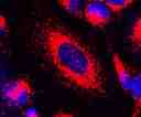 Image of Hela cells stained with LysoBrite™ Red in a Costar black wall-clear bottom 96-well plate.