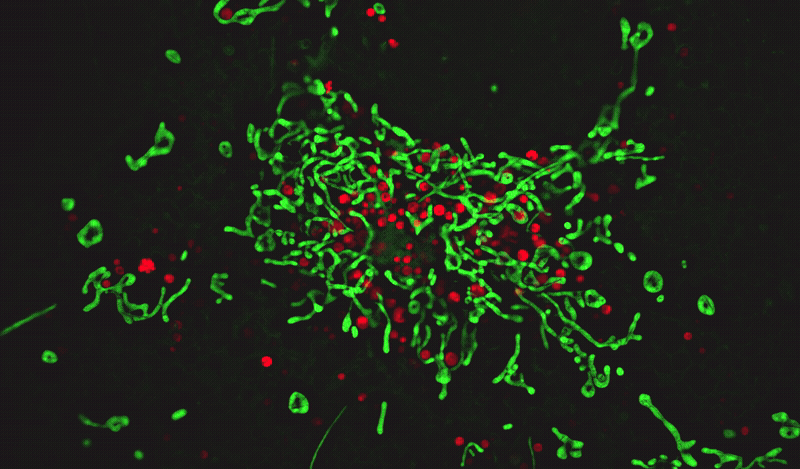 Time-lapse super-resolution fluorescence imaging of live COS-7 cells stained with MitoLite™ Green FM and LysoBrite™ Red. Live COS-7 cells were labeled with MitoLite™ Green FM (Cat. #22695) for mitochondrial staining and LysoBrite™ Red (Cat. #22645) for lysosomal staining. Images were acquired using the CSR Biotech MI-SIM super-resolution microscopy system and reconstructed using standard Wiener reconstruction. The merged sequence shows mitochondria in green and lysosomes in red.
Data credit: Data was generated by CSR Biotech using their MI-SIM microscopy system with MitoLite™ Green FM and LysoBrite™ Red from AAT Bioquest.