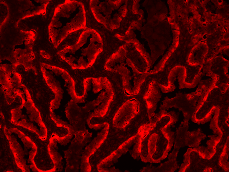 Formalin-fixed, paraffin-embedded (FFPE) human lung tissue was labeled with anti-EpCAM mouse mAb followed by HRP-labeled goat anti-mouse IgG (Cat No. 16728). The fluorescence signal was developed using mFluor™ Blue 580 styramide and detected with a Cy3 filter set.